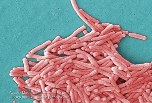300px-Legionella_pneumophila_(SEM)